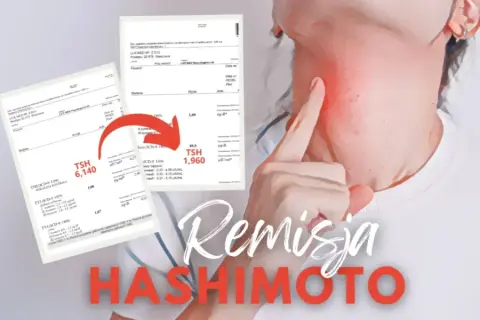 Czy choroba Hashimoto kwalifikuje do renty? Sprawdź kryteria i możliwości