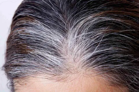 Gros plan sur des cheveux mi-bruns, mi-blancs. Un temps de pause coloration cheveux blancs est peut-être en cours, laissant apparaître des mèches argentées naturelles.