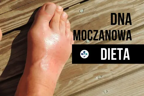 Dna moczanowa: Skuteczna dieta niskopurynowa jedz bez bólu!