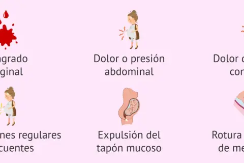 Señales de parto prematuro: sangrado vaginal, dolor abdominal, dolor de espalda, contracciones, expulsión del tapón mucoso y rotura de membranas.