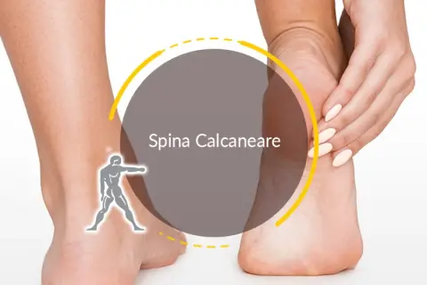Dolore al tallone: un'immagine che illustra la spina calcaneare, con una mano che massaggia la zona dolente.