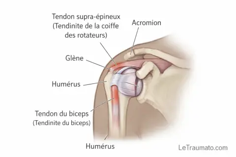 Anatomie de l'épaule montrant le tendon supra-épineux et le tendon du biceps, zones souvent affectées par une tendinite. Cet **exercice tendinite épaule** vise à soulager ces douleurs.