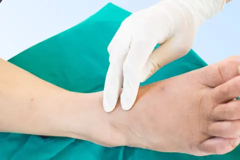 Mano guantata esegue un massaggio per la fisioterapia per neuropatia arti inferiori, concentrandosi sulla caviglia e sul piede.