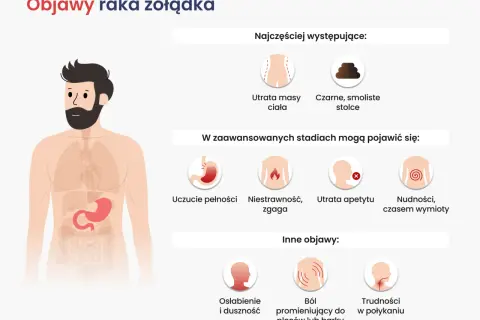 Ilustracja przedstawia objawy raka żołądka: utratę masy ciała, czarne stolce, uczucie pełności, niestrawność, zgagę, utratę apetytu, nudności, wymioty, osłabienie, ból pleców i trudności w połykaniu.