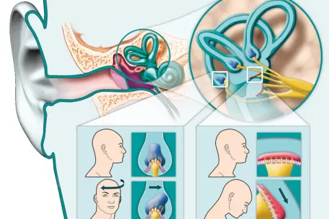 Illustrazione dell'orecchio interno e dei canali semicircolari, con diagrammi che mostrano movimenti della testa per alleviare le vertigini. Rimedi della nonna per cervicale e vertigini.
