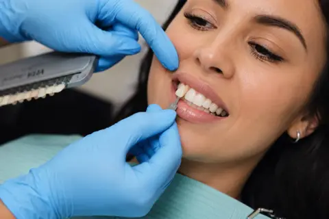 Dobór idealnego odcienia żywicy kompozytowej na zęby. Dentysta porównuje kolor zęba z wzornikiem.