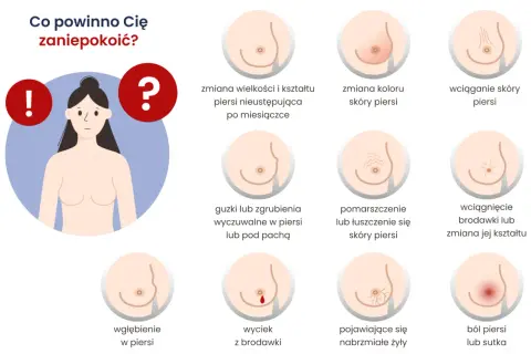 Grafika pokazuje objawy raka piersi: zmiany wielkości, koloru, wciąganie skóry, guzki, wyciek z brodawki, ból.