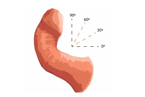 Anatomical illustration showing the penis knura with angles indicating curvature: 0°, 30°, 60°, 90°.