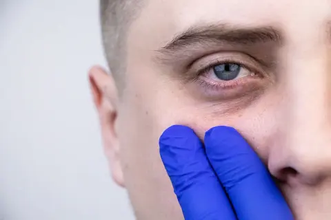 Dłoń w niebieskiej rękawiczce dotyka policzka, uwydatniając dolinę łez.