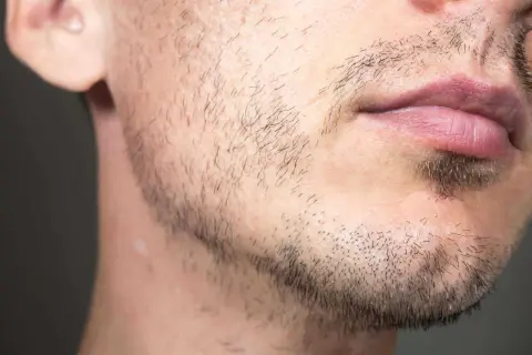 Un homme de 25 ans avec une barbe clairsemée et des lèvres roses. Il a une petite cicatrice sur la joue.