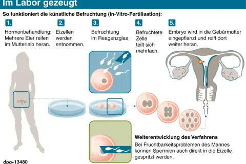 Schema erklärt die IVF-Bedeutung: Hormonbehandlung, Eizellentnahme, Befruchtung im Reagenzglas, Zellteilung, Embryotransfer in die Gebärmutter.