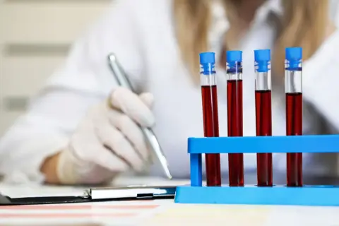 Laborantka w białej rękawiczce pisze coś długopisem, obok stoją probówki z krwią.INR.
