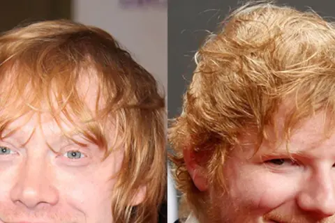 Czy Ed Sheeran grał w Harrym Potterze? Prawda o jego udziale