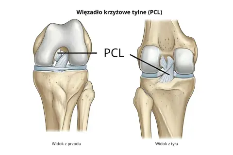 Anatomia stawu kolanowego: widok z przodu i z tyłu, ukazujący kości kończyny dolnej i więzadło krzyżowe tylne (PCL).
