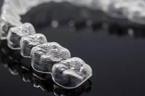 Mascherine trasparenti per allineamento dentale, un esempio di come si presentano i denti con Invisalign. Ogni quanto si cambiano le mascherine?