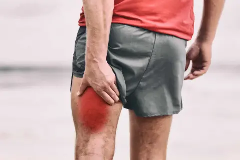 Un corridore si tiene la coscia, evidenziata in rosso, a causa di gambe intorpidite.