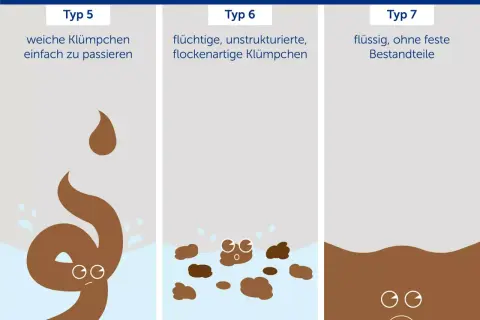 Durchfall: Typ 7 zeigt flüssigen, hellbraunen Stuhl wie Wasser, ohne feste Bestandteile.