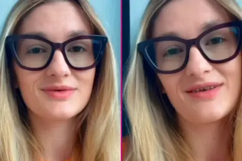 Uśmiechnięta blondynka w okularach, z widocznymi tureckie zęby.