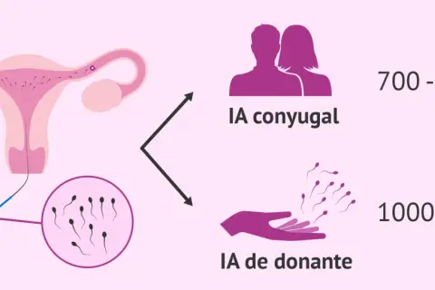 IA conyugal: 700-1100€. IA donante: 1000-1700€. Descubre cuanto cuesta una inseminación artificial en España.