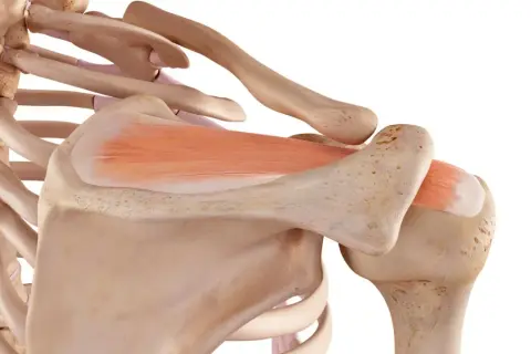 Dettaglio anatomico della spalla con ossa e muscoli. Un tendine lesionato può guarire, grazie alla resilienza del corpo umano.