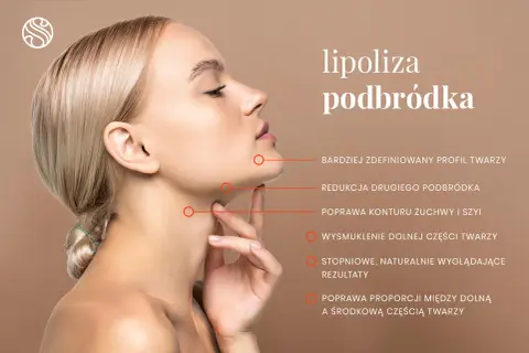 Profil kobiety po zabiegu lipolizy podbródka. Widoczna poprawa konturu żuchwy i szyi, wysmuklenie dolnej części twarzy.
