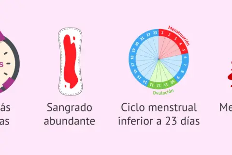 Señales para saber si me va a bajar la regla: duración >8 días, sangrado abundante, ciclo <23 días o metrorragia.