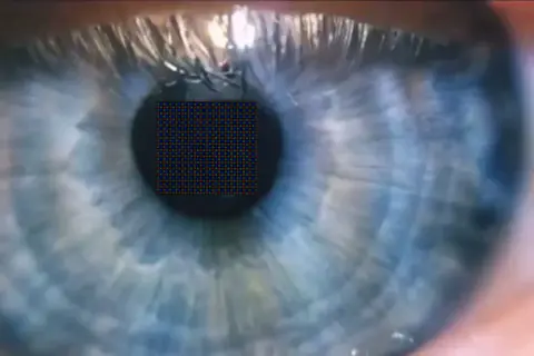 Un occhio umano, con un reticolo di pixel sovrapposto, suggerisce quanti pixel ha l'occhio umano.