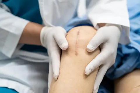Rehabilitacja po endoprotezie kolana: Ile trwa i co musisz wiedzieć?