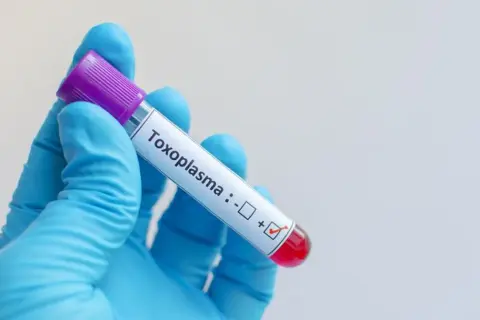 Rękawiczka w niebieskiej rękawiczce trzyma probówkę z oznaczeniem "Toxoplasma", z zaznaczonym wynikiem dodatnim. Badanie na toksoplazmozę objawy.