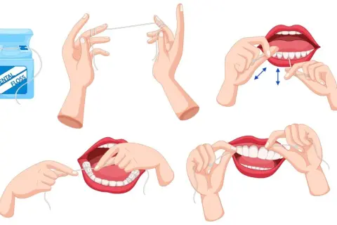 Ilustracja pokazuje jak używać nić dentystyczną do czyszczenia zębów.