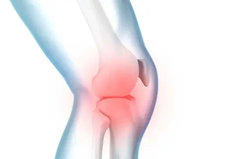 Illustration eines menschlichen Knies mit roter Hitze, die **Spannung im Knie** symbolisiert.