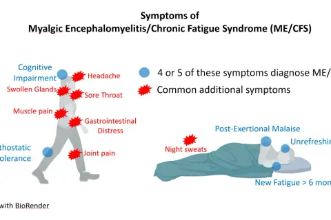 ME/CFS: Objawy, PEM, diagnoza. Czy to już choroba?