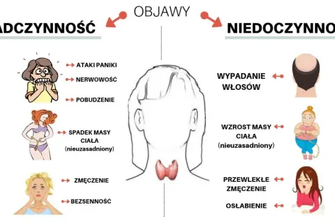 Niedoczynność tarczycy u nastolatków objawy, które mogą cię zaniepokoić