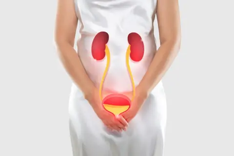 Kobieta w białej sukni, z grafiką układu moczowego. Może to symbolizować parcie na pęcherz przyczyny ginekologiczne.