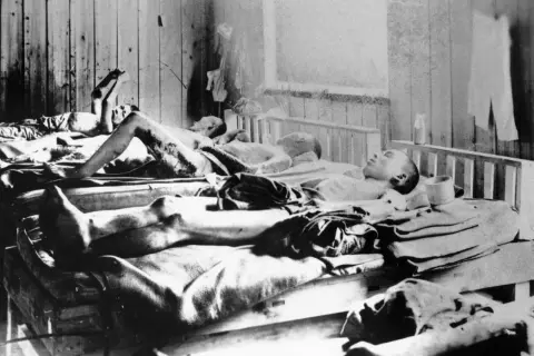 Ludzie poparzeni po katastrofie w Czarnobylu leżą na łóżkach szpitalnych, ich ciała noszą ślady obrażeń.