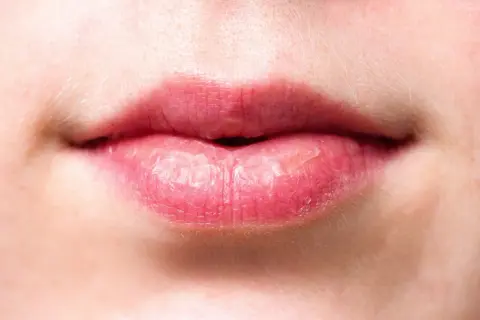 Nahaufnahme von Lippen. Trockene Lippen können ein Zeichen dafür sein, dass der Speichelfluss nachts angeregt werden muss.
