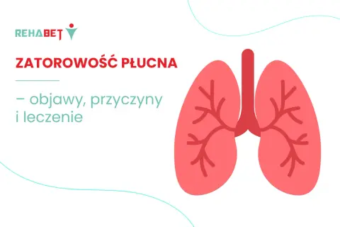 Grafika przedstawia płuca z napisem "ZATOROWOŚĆ PŁUCNA – objawy, przyczyny i leczenie".