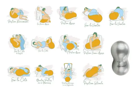 Illustrations montrant diverses positions d'accouchement avec un ballonnet, incluant des postures assises, latérales et sur le ventre. Un ballonnet d'accouchement est aussi visible.