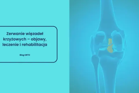Ilustracja przedstawia zerwane więzadło krzyżowe w kolanie. Czy zerwane więzadło boli? Dowiedz się o objawach, leczeniu i rehabilitacji.
