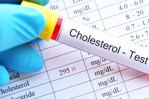 Jak czytać wyniki cholesterolu i unikać zdrowotnych zagrożeń