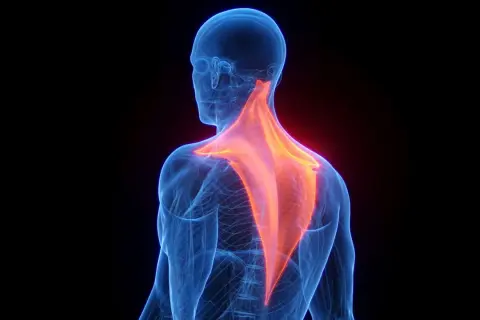 Vue anatomique du dos humain, mettant en évidence les muscles trapèzes en rouge vif, symbolisant la douleur trapeze.