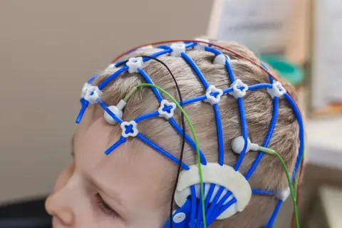 Barn med EEG-hjälm för utredning av adhd behandling.