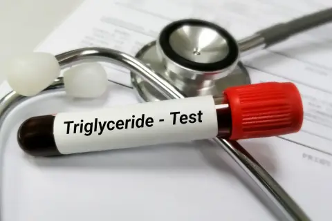 Probówka z krwią do badania trójglicerydów leży na stetoskopie. Wysokie trójglicerydy mogą wpływać na samopoczucie.
