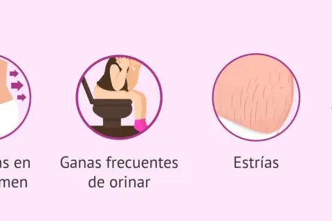 Ilustraciones de molestias comunes en **17 semanas de embarazo**: abdomen, ganas de orinar, estrías y calambres.