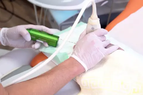 Brustbiopsie mit Magnum-Gerät. Die meisten Ergebnisse bei einer Biopsie der Brust sind gutartig.