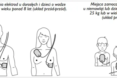 AED: Kiedy NIE używać? Sprawdź przeciwwskazania i mity