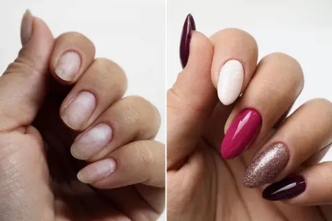 Przed i po: zniszczone paznokcie odzyskują piękno dzięki nadbudowie paznokcia żelem. Efekt: elegancki manicure w odcieniach śliwki, różu i bieli.