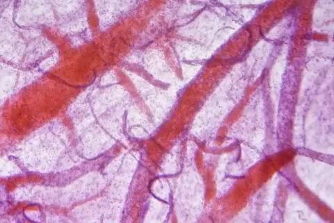 Mikroskopowa angiografia ukazuje sieć naczyń krwionośnych w kolorze czerwonym na fioletowym tle.
