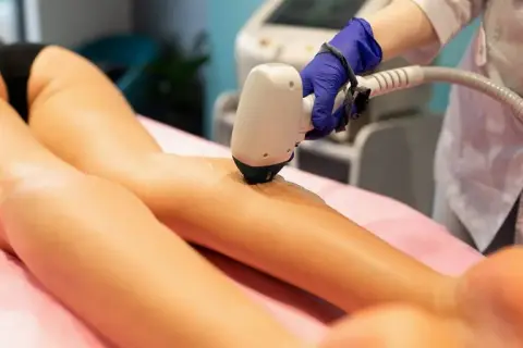 Ile trwa depilacja laserowa? Sesja i cała kuracja fakty