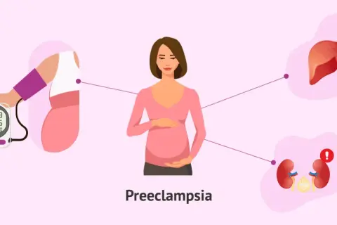 Ilustración de una mujer embarazada con un tensiómetro, hígado y riñones, mostrando los **preeclampsia riesgos** y sus efectos.